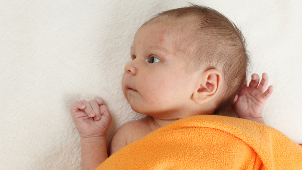 lait d'anesse pour traiter l'eczema de bébé